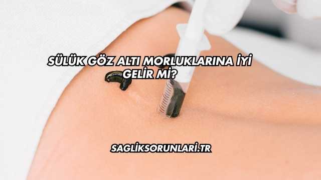 Sülük Göz Altı Morluklarına İyi Gelir mi?