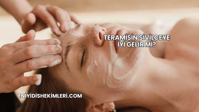 Teramisin Sivilceye İyi Gelir mi?