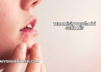 Teramisin Uçuğa İyi Gelir mi?