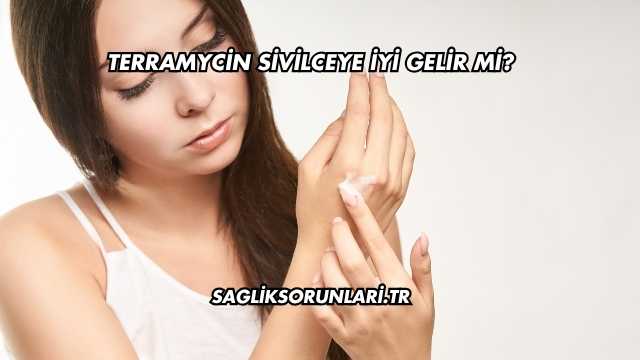 Terramycin Sivilceye İyi Gelir mi?