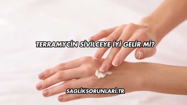 Terramycin Sivilceye İyi Gelir mi?