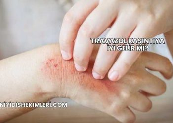 Travazol Kaşıntıya İyi Gelir mi?