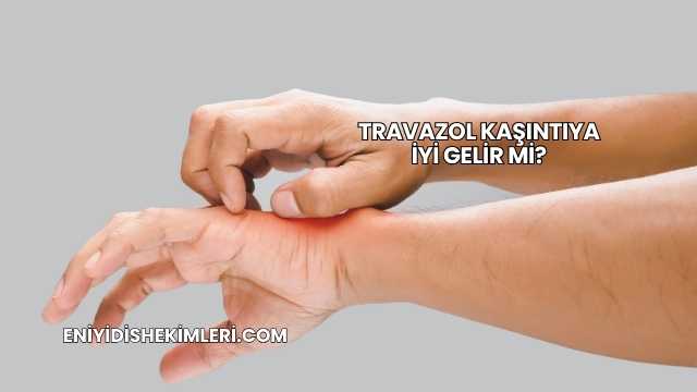 Travazol Kaşıntıya İyi Gelir mi?