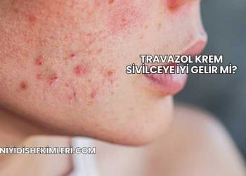Travazol Krem Sivilceye İyi Gelir mi?