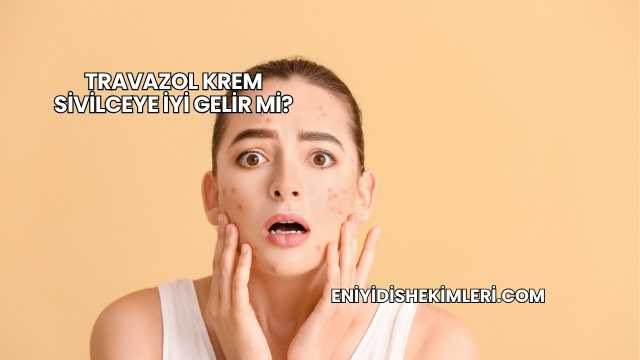 Travazol Krem Sivilceye İyi Gelir mi?