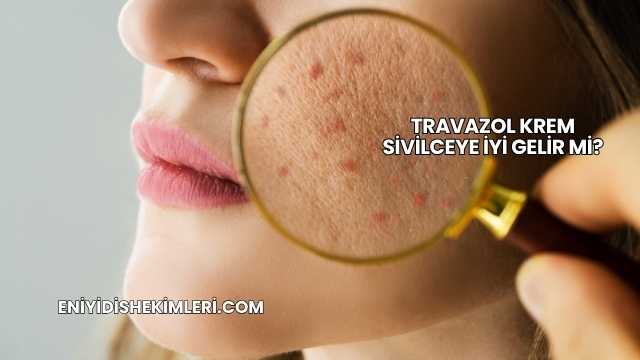 Travazol Krem Sivilceye İyi Gelir mi?