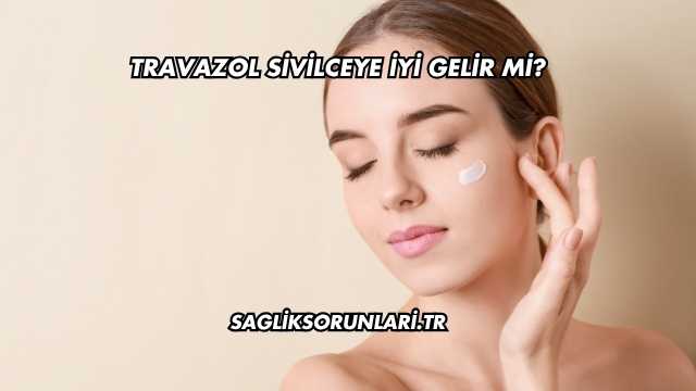 Travazol Sivilceye İyi Gelir mi?