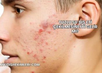 Tuzlu Su Diş Eti Çekilmesine İyi Gelir mi?