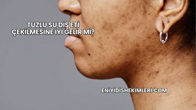 Tuzlu Su Diş Eti Çekilmesine İyi Gelir mi?