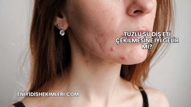 Tuzlu Su Diş Eti Çekilmesine İyi Gelir mi?