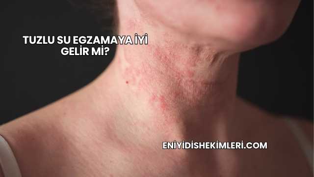 Tuzlu Su Egzamaya İyi Gelir mi?