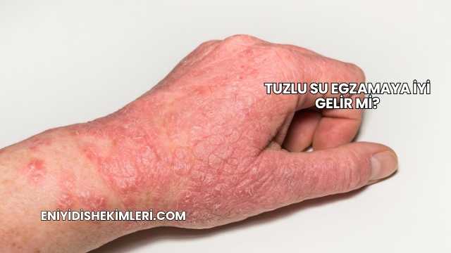 Tuzlu Su Egzamaya İyi Gelir mi?