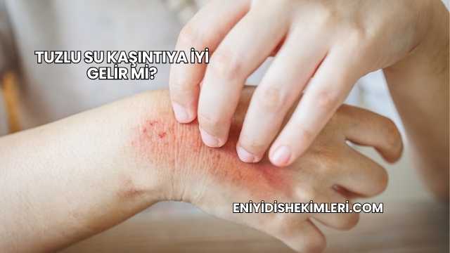 Tuzlu Su Kaşıntıya İyi Gelir mi?