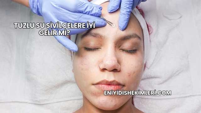 Tuzlu Su Sivilcelere İyi Gelir mi?