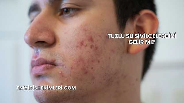 Tuzlu Su Sivilcelere İyi Gelir mi?
