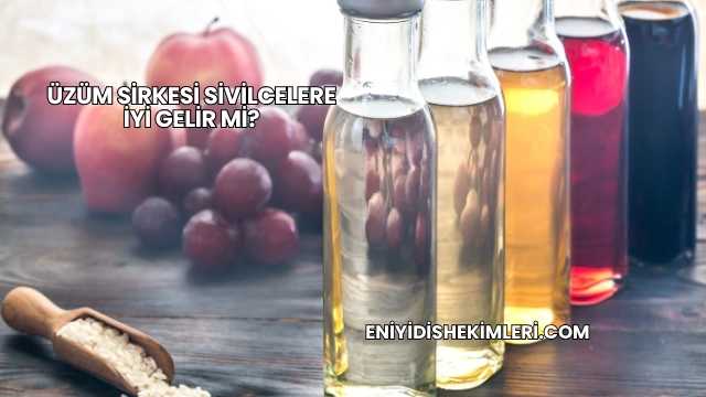 Üzüm Sirkesi Sivilcelere İyi Gelir mi?