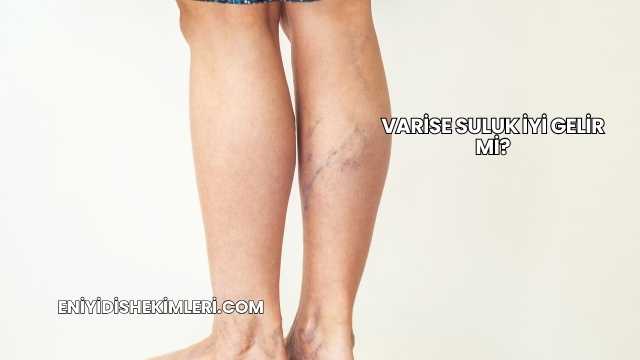 Varise Suluk İyi Gelir mi?