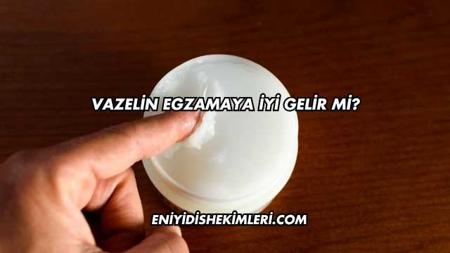 Vazelin Egzamaya İyi Gelir mi?