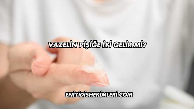 Vazelin Pişiğe İyi Gelir mi?