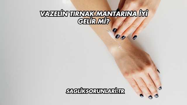 Vazelin Tırnak Mantarına İyi Gelir mi?