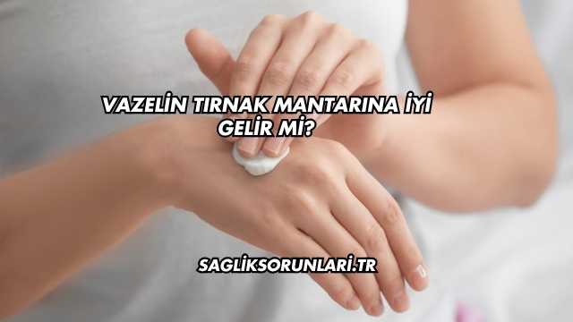 Vazelin Tırnak Mantarına İyi Gelir mi?