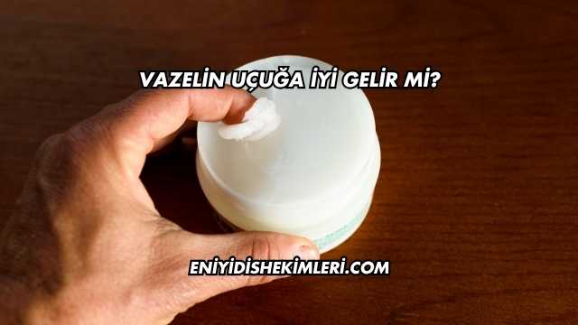Vazelin Uçuğa İyi Gelir mi?