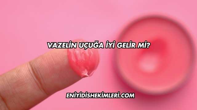 Vazelin Uçuğa İyi Gelir mi?