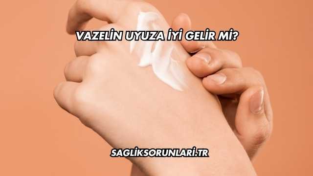 Vazelin Uyuza İyi Gelir mi?