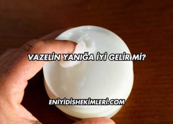 Vazelin Yanığa İyi Gelir mi?