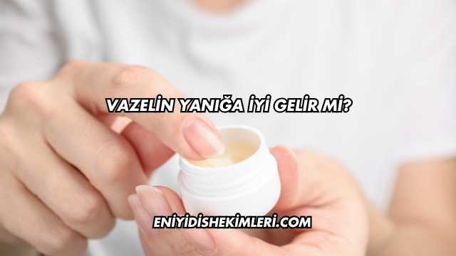 Vazelin Yanığa İyi Gelir mi?