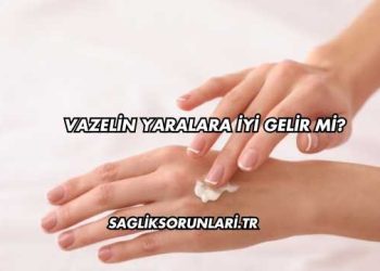 Vazelin Yaralara İyi Gelir mi?
