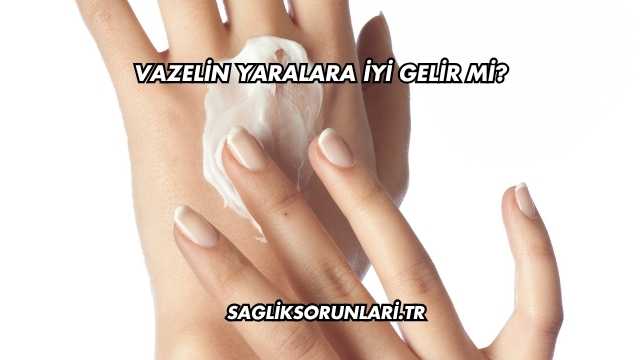 Vazelin Yaralara İyi Gelir mi?