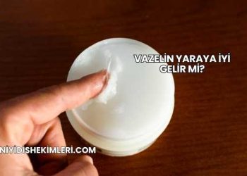 Vazelin Yaraya İyi Gelir mi?