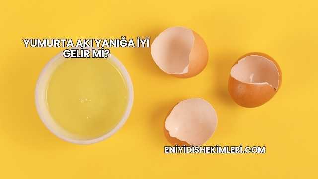 Yumurta Akı Yanığa İyi Gelir mi?