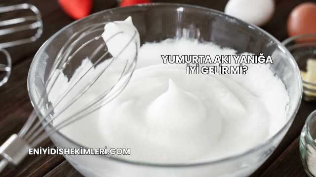 Yumurta Akı Yanığa İyi Gelir mi?