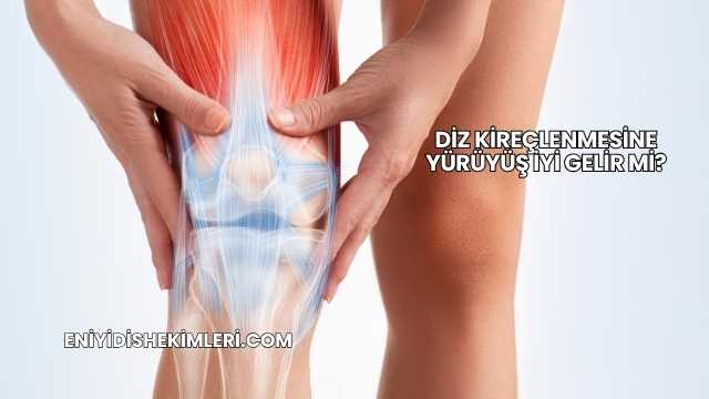 Diz Kireçlenmesine Yürüyüş İyi Gelir mi?