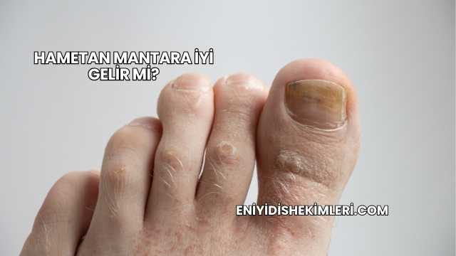 Hametan Mantara İyi Gelir mi?