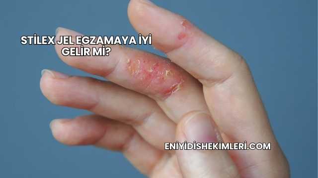 Stilex Jel Egzamaya İyi Gelir mi?
