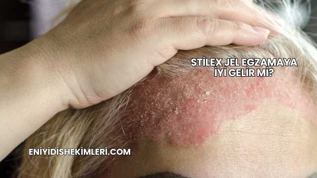 Stilex Jel Egzamaya İyi Gelir mi?