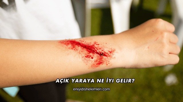 Açık Yaraya Ne İyi Gelir?