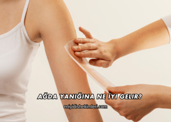 Ağda Yanığına Ne İyi Gelir?