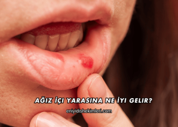 Ağız İçi Yarasına Ne İyi Gelir