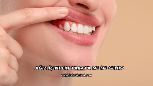 Ağız İçindeki Yaraya Ne İyi Gelir?