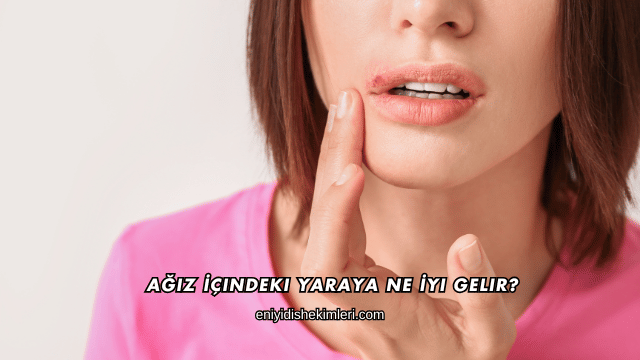 Ağız İçindeki Yaraya Ne İyi Gelir?