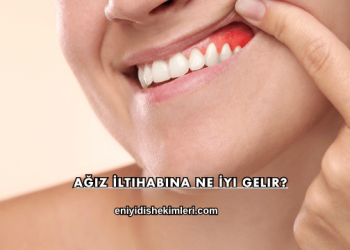 Ağız İltihabına Ne İyi Gelir?