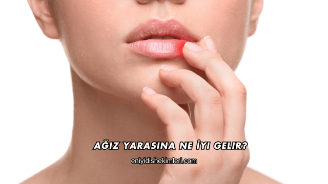 Ağız Yarasına Ne İyi Gelir?