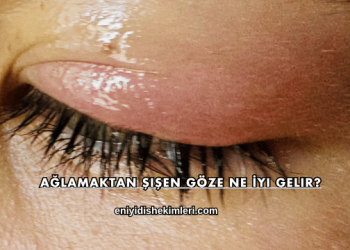 Ağlamaktan Şişen Göze Ne İyi Gelir?