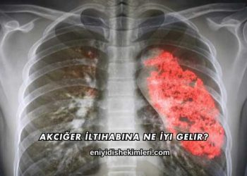 Akciğer İltihabına Ne İyi Gelir?