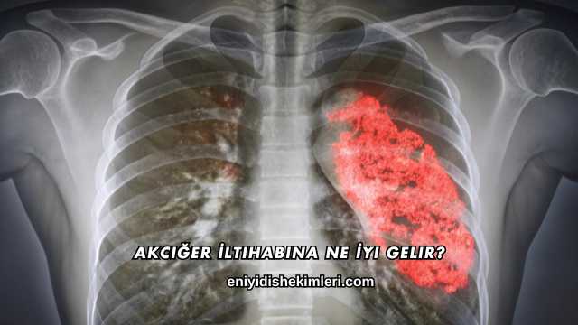 Akciğer İltihabına Ne İyi Gelir?