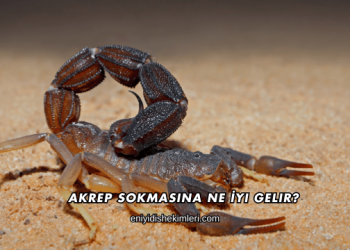 Akrep Sokmasına Ne İyi Gelir?
